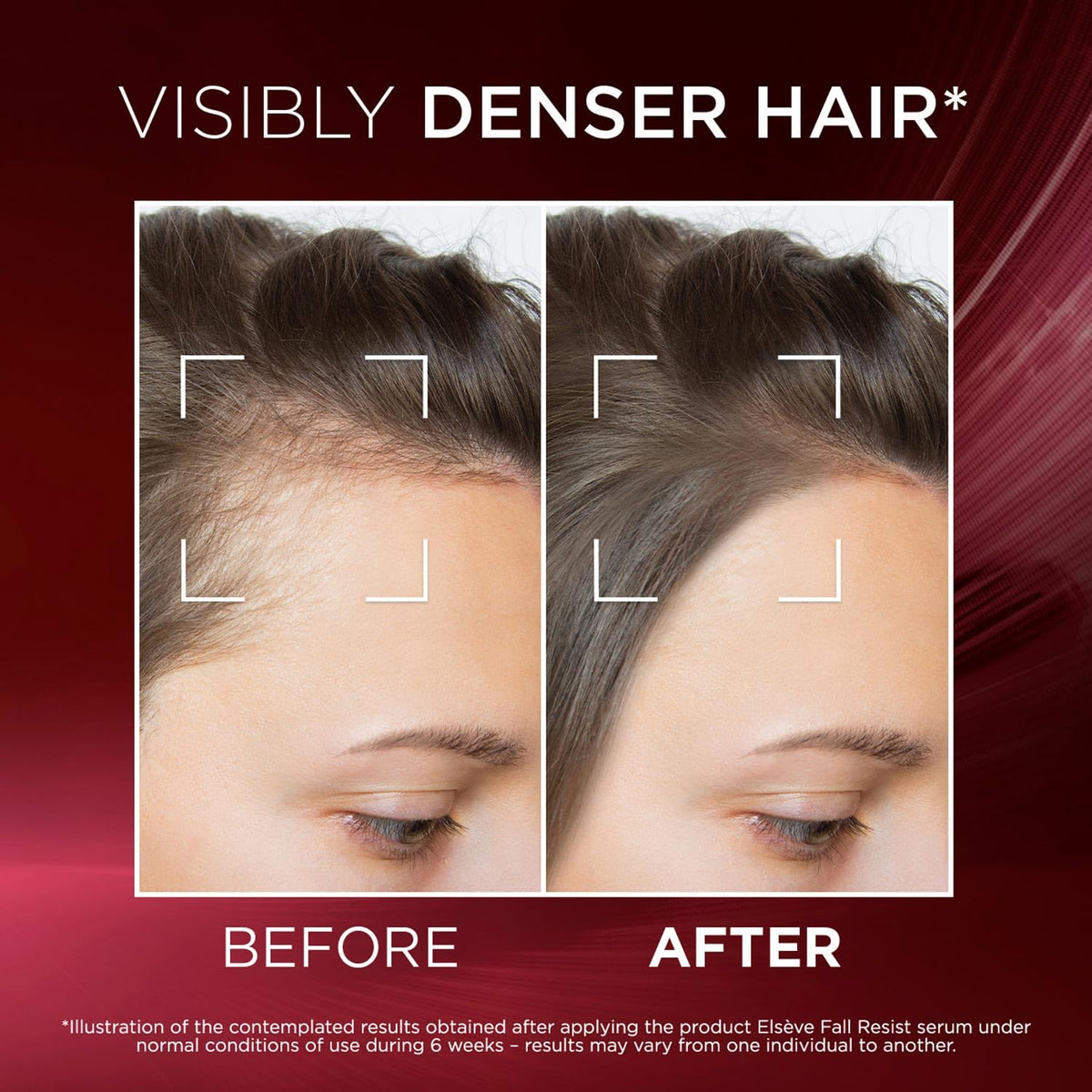 L'Oréal Paris Fall Resist Anti Hair Fall Serum with 1.5% Aminexil