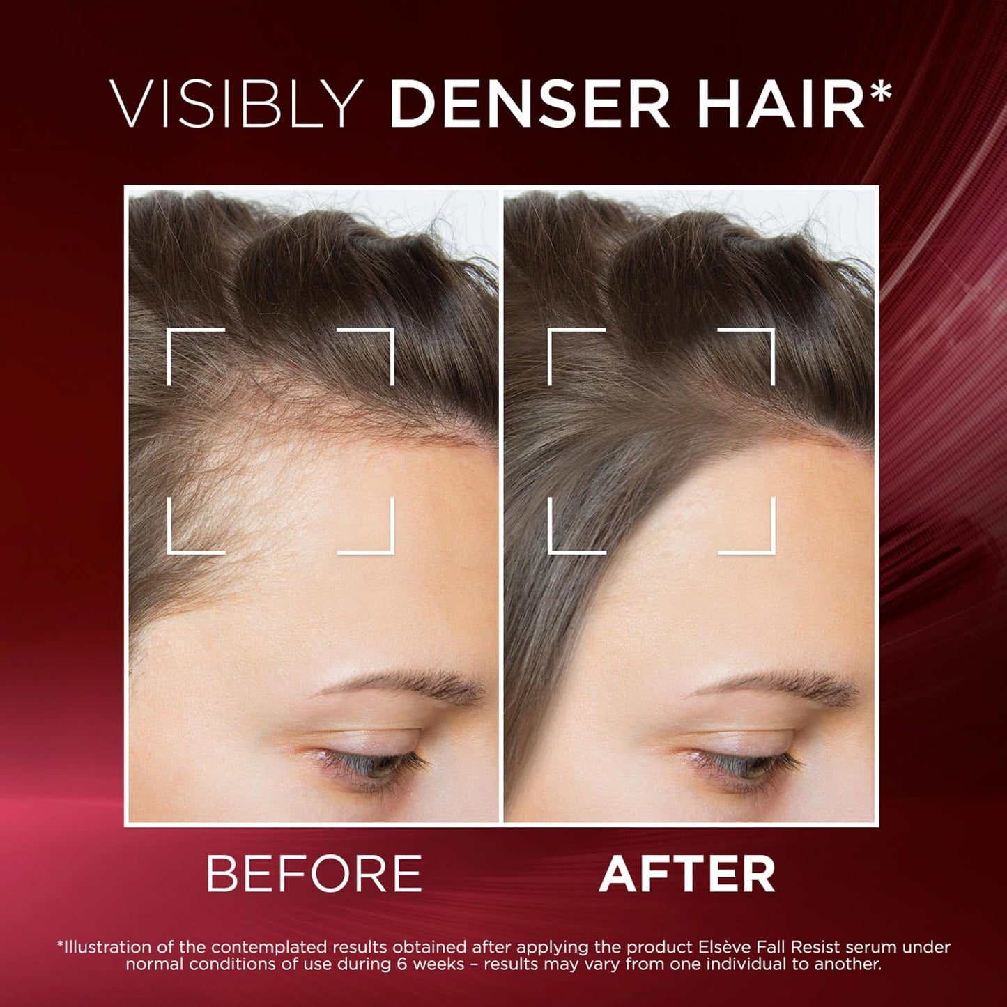 L'Oréal Paris Fall Resist Anti Hair Fall Serum with 1.5% Aminexil