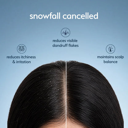 Dandruff Control Shot